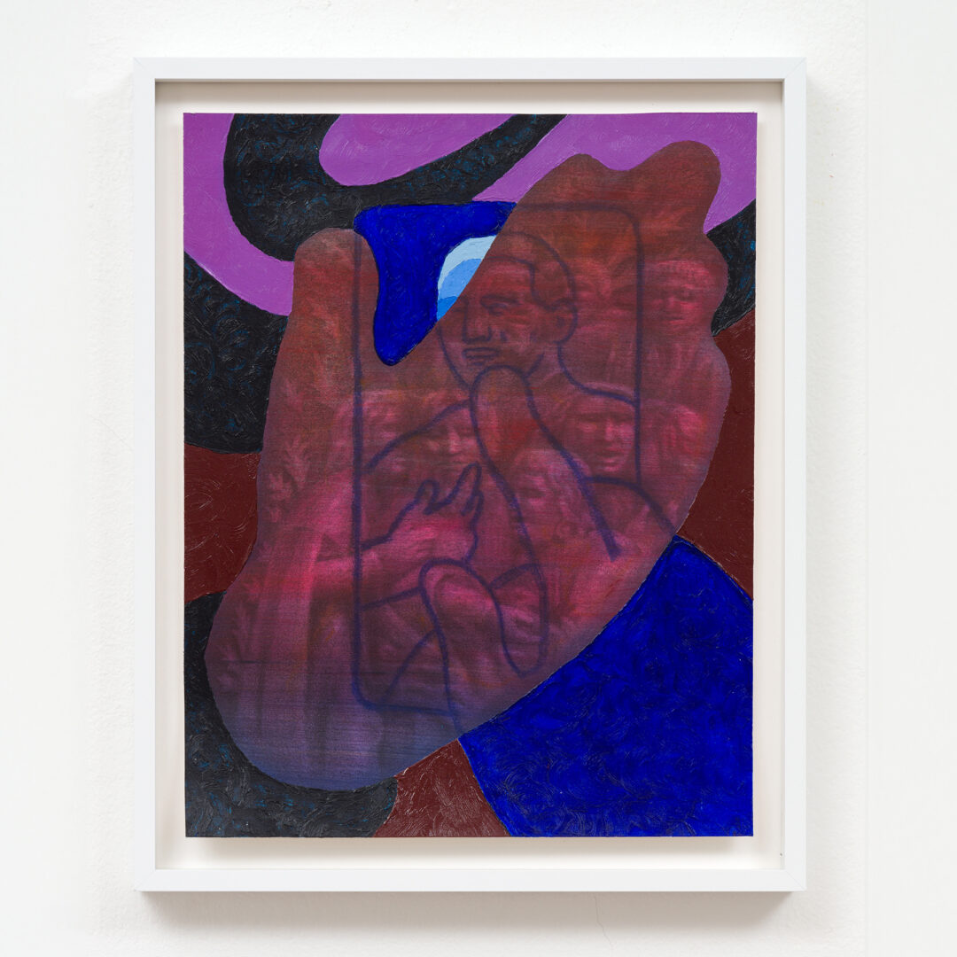 Hyperrelief Hands